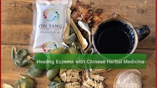 Chinese Herbal Medicine for Eczema [upl. by Ssew217]