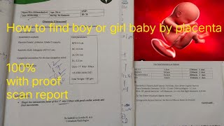 My boy amp girl baby placenta position with scan reportHow to identify boy scan report posterior [upl. by Dnomaj]