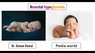 Neonatal hypoglycemia [upl. by Althea592]