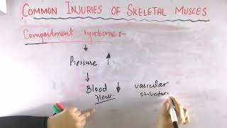 Compartment syndrome  Common injuries of skeletal muscle  Biomechanics of skeletal muscle [upl. by Edna]