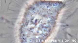 Mitosis  Time lapse photography phase contrast [upl. by Aleik]