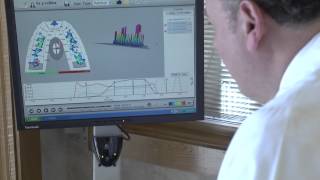 Dentist Performs TekScan Computerized Bite Force Analysis [upl. by Daffi112]