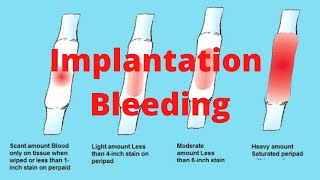 Implantation Bleeding  Know [upl. by Dagney]