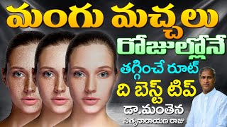 How to Remove DARK SPOTS BLACK SPOTS  Mangu Machalu  Dr Manthena Satyanarayana Raju Videos [upl. by Samuelson]