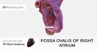 Fossa ovalis of right atrium [upl. by Lak]