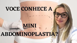 Mini Abdominoplastia [upl. by Shing]