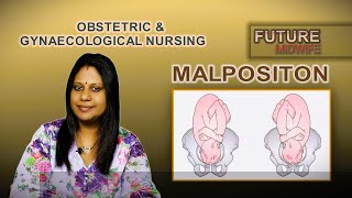 FETAL MALPOSITIONDHANYA DEEPUHIGH RISK LABOUR [upl. by Adella814]