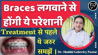 Braces लगवाने से होंगी ये परेशानी।। Problem after braces।। Orthodontic treatment।।braces treatment।। [upl. by Tadeas186]