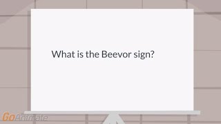 What is the Beevor sign [upl. by Nyad870]