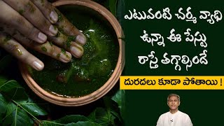 Home Remedy to Treat Skin Rashes  Reduces Itching  Skin Infections  Dr Manthenas Beauty Tips [upl. by Naeroled]