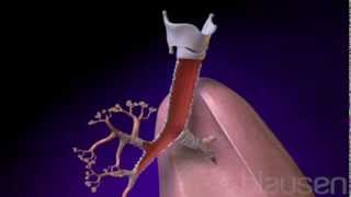 Bronchitis Animation [upl. by Asoramla]