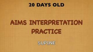 AIMS INTERPRETATION amp SCORING PRACTICE 20 Days OF AGE No Verbal Cues [upl. by Thoma]