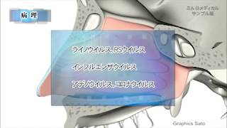 急性鼻炎／2分で分かる医療動画辞典 ミルメディカル [upl. by Airan]