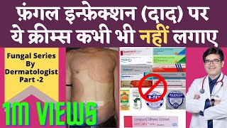 Ringworm Fungal Infection Treatment In Hindi  Fungal Infection Cream Without Steroids  Dr Sunil [upl. by Carbone]