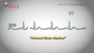 Normal Sinus Rhythm by ACLS Certification Institute [upl. by Chansoo906]