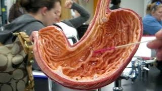 Human Stomach Splitting into 2 Sections Right NOW The Pylorus Mandela Effect [upl. by Nicolau821]