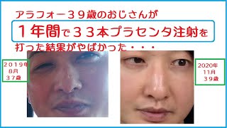 プラセンタ注射を１年間で３３本継続して打ち続けた結果をお話致します。プラセンタ注射についてまとめております。 [upl. by Anerda]