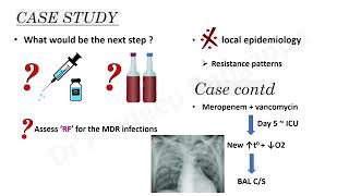 CeftazidimeAvibactum Case StudyDr Pradeep Rangappa [upl. by Neale]