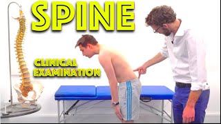 Spine Examination  Back Pain Assessment  4K  Clinical Skills  Dr Gill [upl. by Meredi]