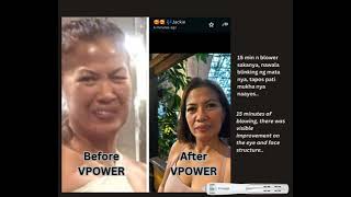 Viiva Vpower Terahertz Blower Bells Palsy Testimony viiva vpower sei [upl. by Sedda]