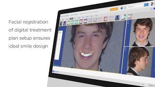 SureSmile® Aligner More than just invisible All new option for all Clinicians [upl. by Martainn]