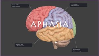 Brocas or Wernickes Aphasia on the NPTE [upl. by Nad]