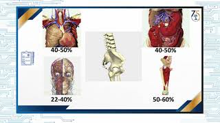 Paciente politraumatizado con fractura de pelvis ¿control de daño [upl. by Aerdnaek]