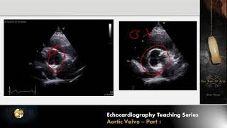 Lecture 9  Aortic Valve Part 1 [upl. by Darryn625]