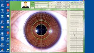 Iriscope iris analyzer iridology [upl. by Mora792]