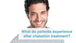 What do patients experience after chalazion incision and curettage surgery at Clinica London [upl. by Yeargain389]