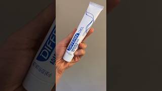 Adapalene Gel For Lightening Sun Spots dermatologist [upl. by Joni907]