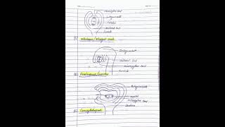 TYPES OF OVULES [upl. by Ayoj]