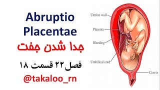 جدا شدن جفت، فصل22 قسمت 18 Abruptio Placentae for NclexRN [upl. by Choong]