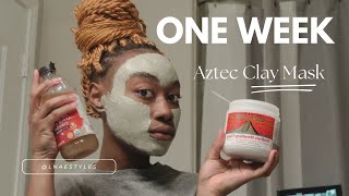 This Mask Brought My Face To Life  Bentonite Clay [upl. by Enelad]