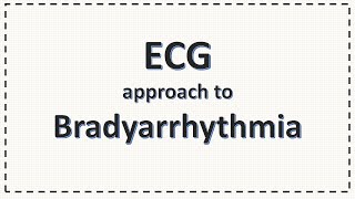 ECG Approach to Bradyarrhythmia  Bradycardia  Simplified [upl. by Nashbar602]