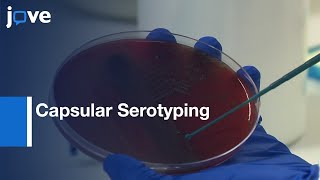 Capsular Serotyping Streptococcus pneumoniae Using Quellung Reaction [upl. by Ajani]