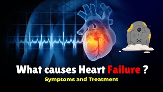 What causes Heart Failure  Congestive Heart Failure Symptoms Stages amp Treatment [upl. by Yardna]