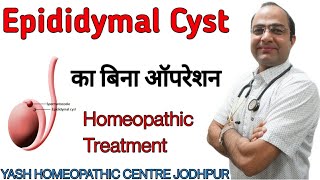 Epididymitis cyst homeopathic medicines epididymitis treatment in hindi  pain and cause [upl. by Mervin]