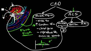 Pathophysiology of Coronary Artery Disease [upl. by Immas]