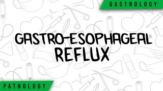 GastroEsophageal Reflux  Physiopathology Symptoms Complications Treatment [upl. by Wolsniw643]