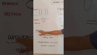 Urostomy nursingskills nursingstudent nursing [upl. by Amend]