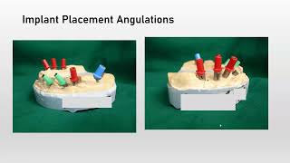 Season 1 Ep 4  Power Up Your Digital Workflow Advanced Digital Imaging Leading to PrecisionGuide [upl. by Eisset]