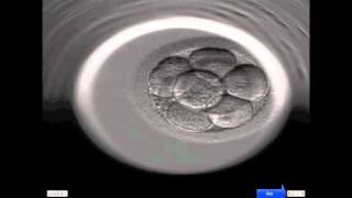 INSTITUT MARQUÈS  Ansicht der Entwicklung eines menschlichen Embryos durch das Embryoscope [upl. by Thornburg446]