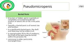 Micropenis and Delayed Puberty A Comprehensive Approach to Diagnosis and Treatment Prof Jamal Raza [upl. by Kippar]