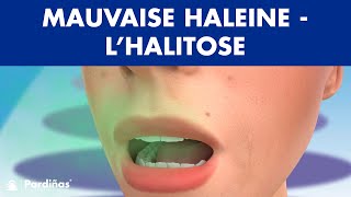 Santé  comment remédier à la mauvaise haleine [upl. by Eamanna]