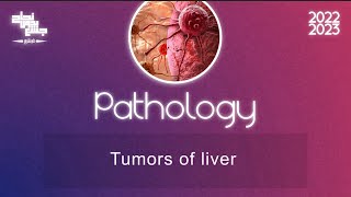 L3 Hepatobiliary neoplasms Pathology [upl. by Airottiv453]