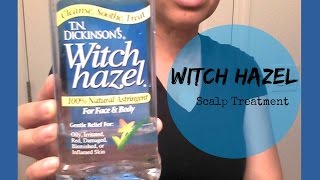 Scalp Treatment w WITCH HAZEL  Natural Hair [upl. by Ahsitniuq]