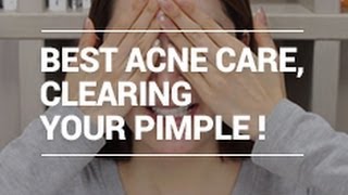 The Best ACNE Care Tips for Clearing Pimple with Eunices naked face XD  Wishtrend [upl. by Seve]