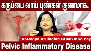 கருப்பை வாய் புண் விரைவில் குணமாக  Cure For Pelvic inflammatory Disease  DrDeepa Arulaalan ssc [upl. by Vidovic]