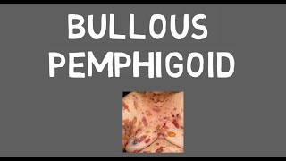 Bullous pemphigoid [upl. by Unni]